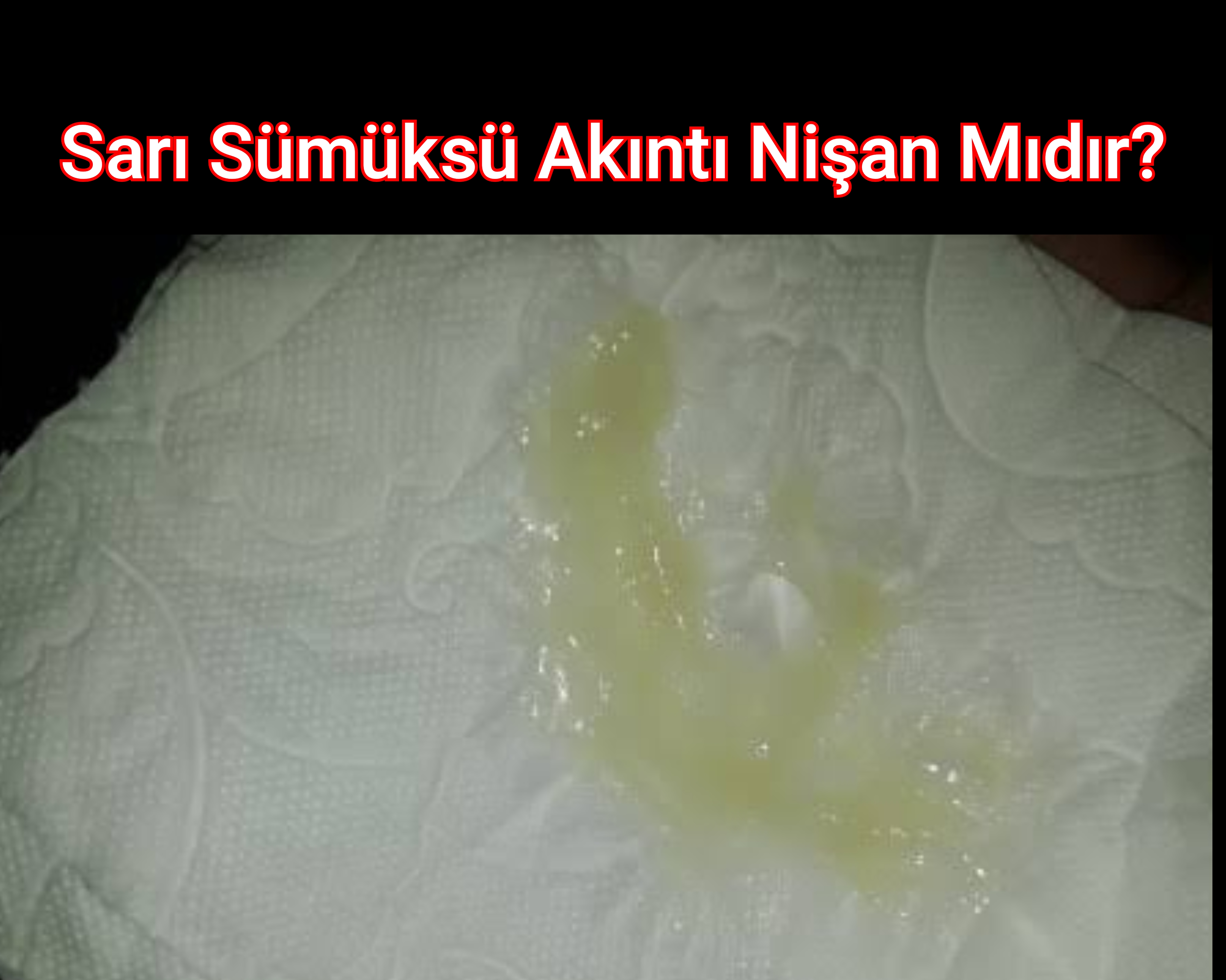 Sarı Sümüksü Akıntı Nişan Mıdır?