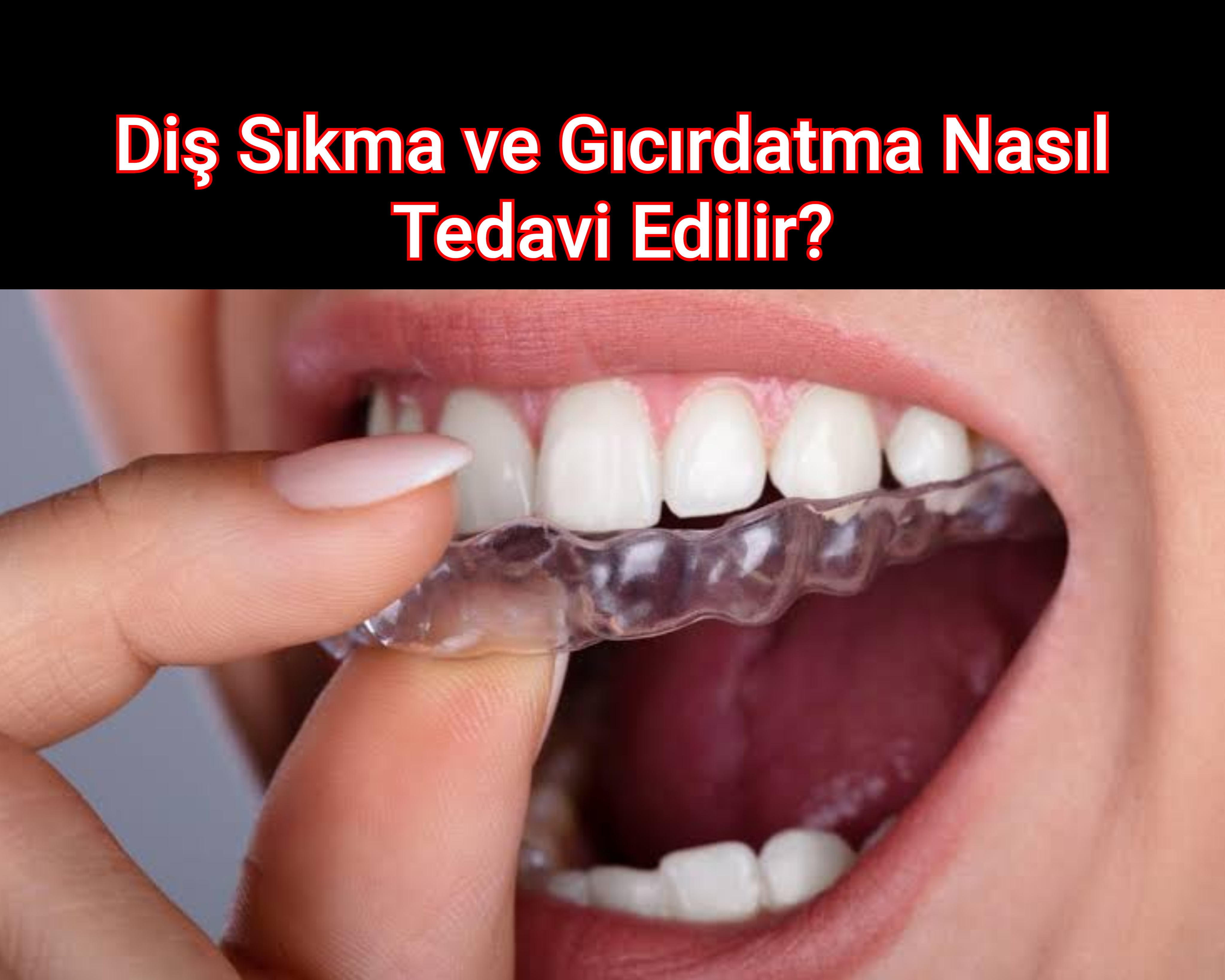 Diş Sıkma ve Gıcırdatma Nasıl Tedavi Edilir?
