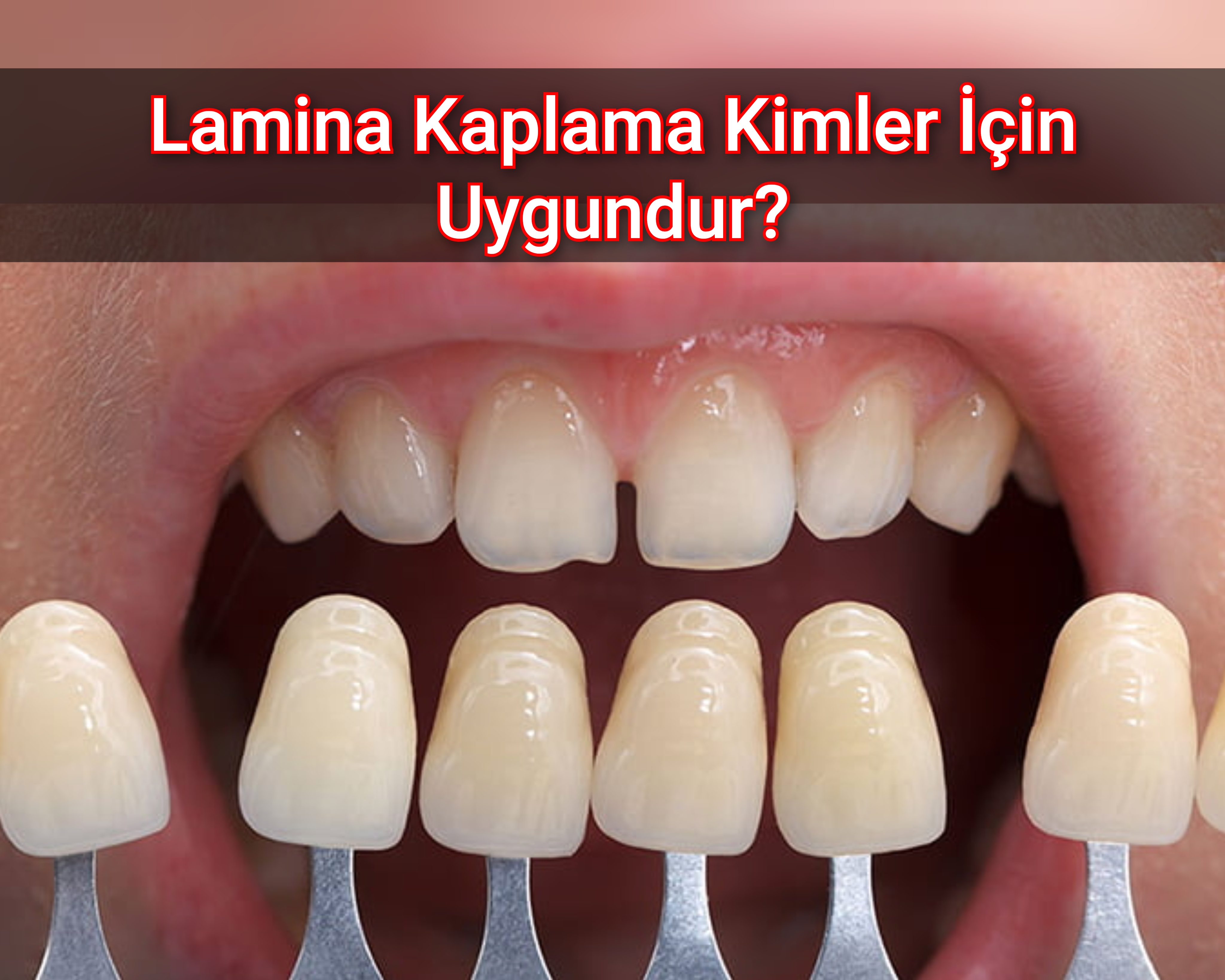 Lamina Kaplama Kimler İçin Uygundur?