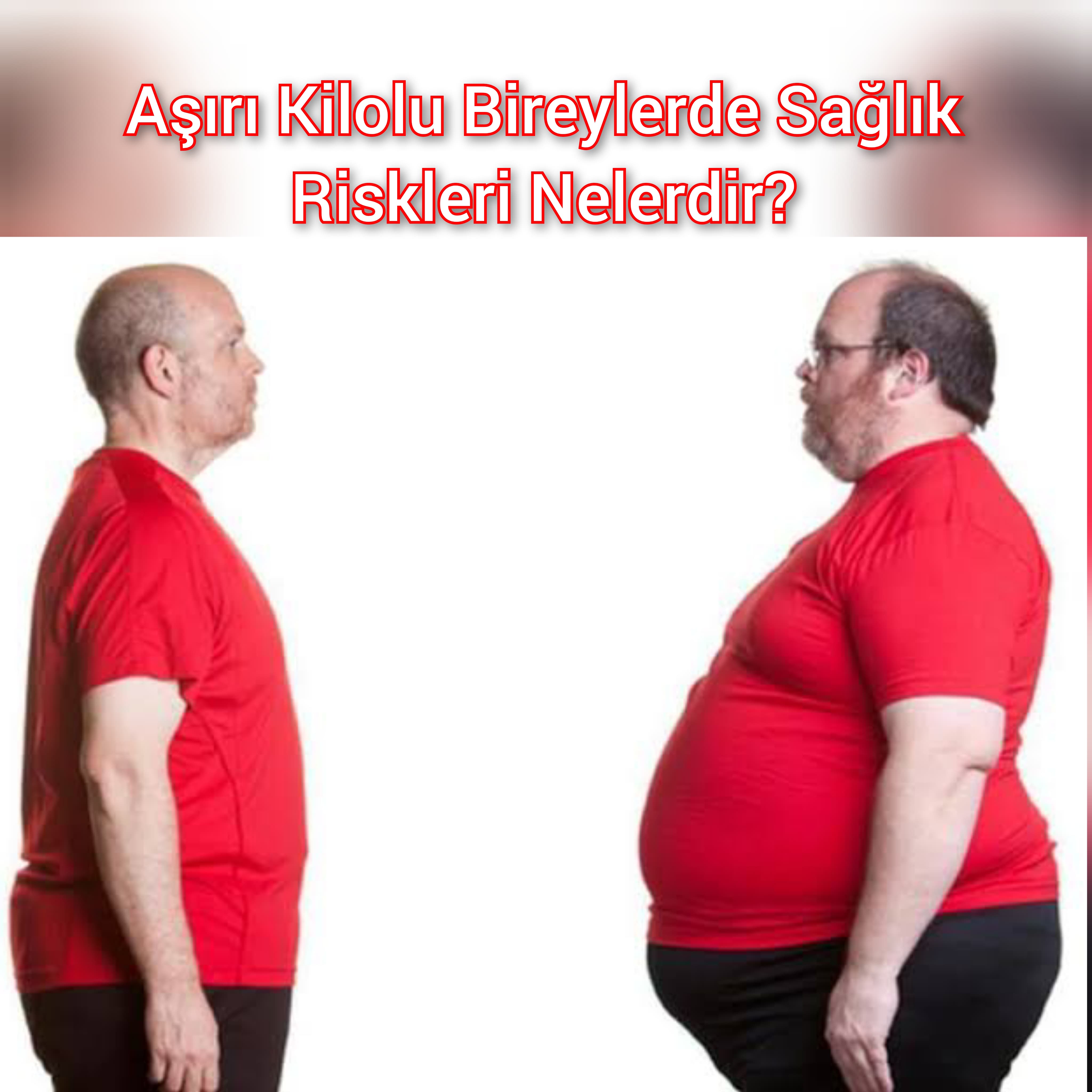 Aşırı Kilolu Bireylerde Sağlık Riskleri Nelerdir?