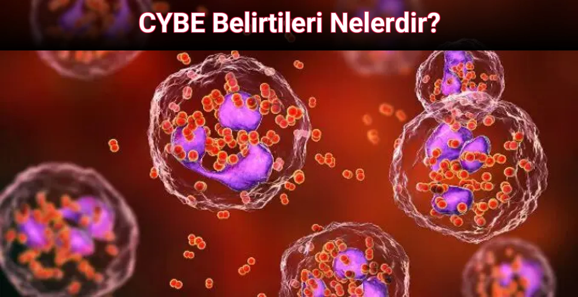 CYBE Belirtileri Nelerdir?