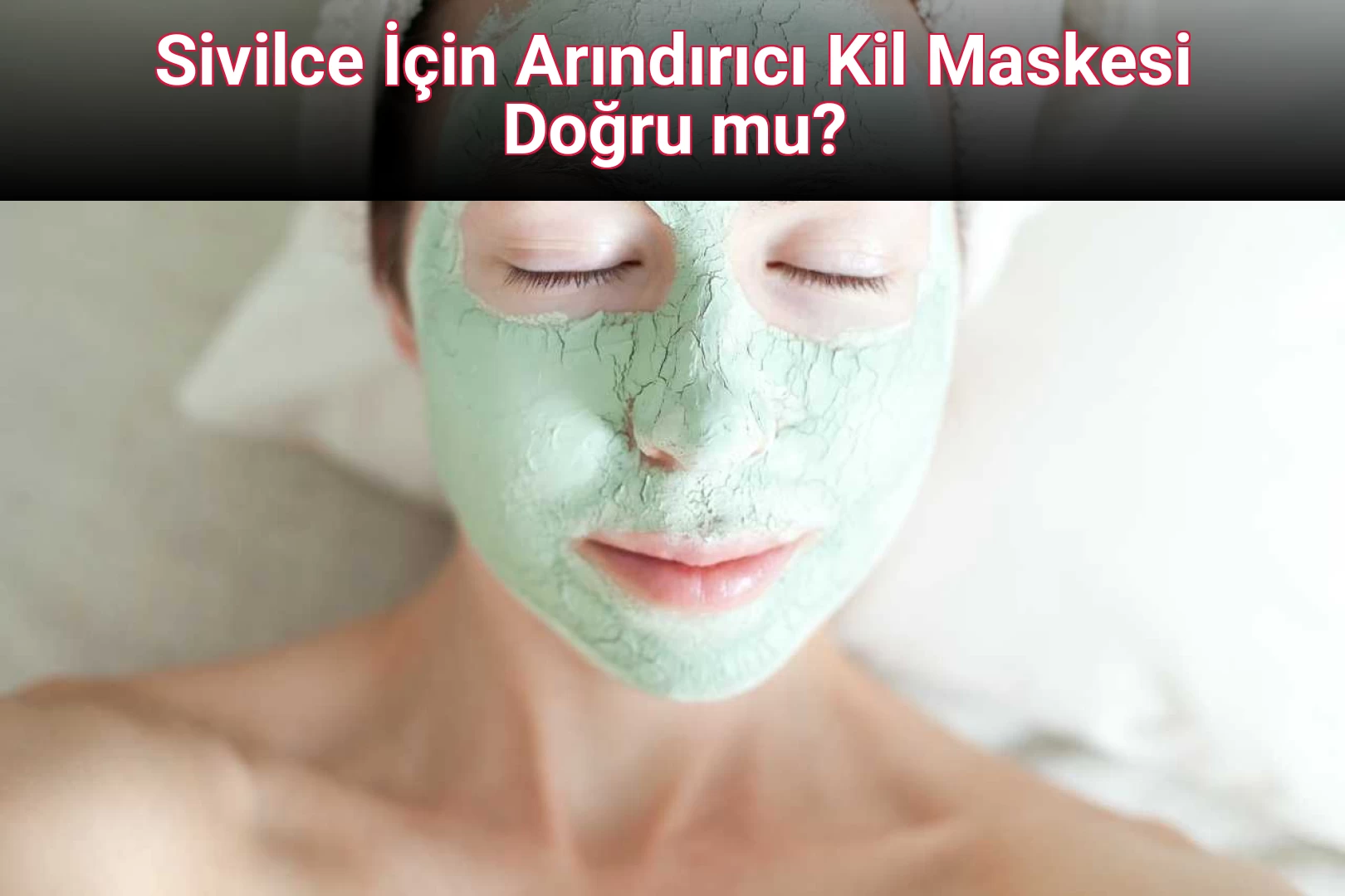Sivilce İçin Arındırıcı Kil Maskesi Doğru mu?