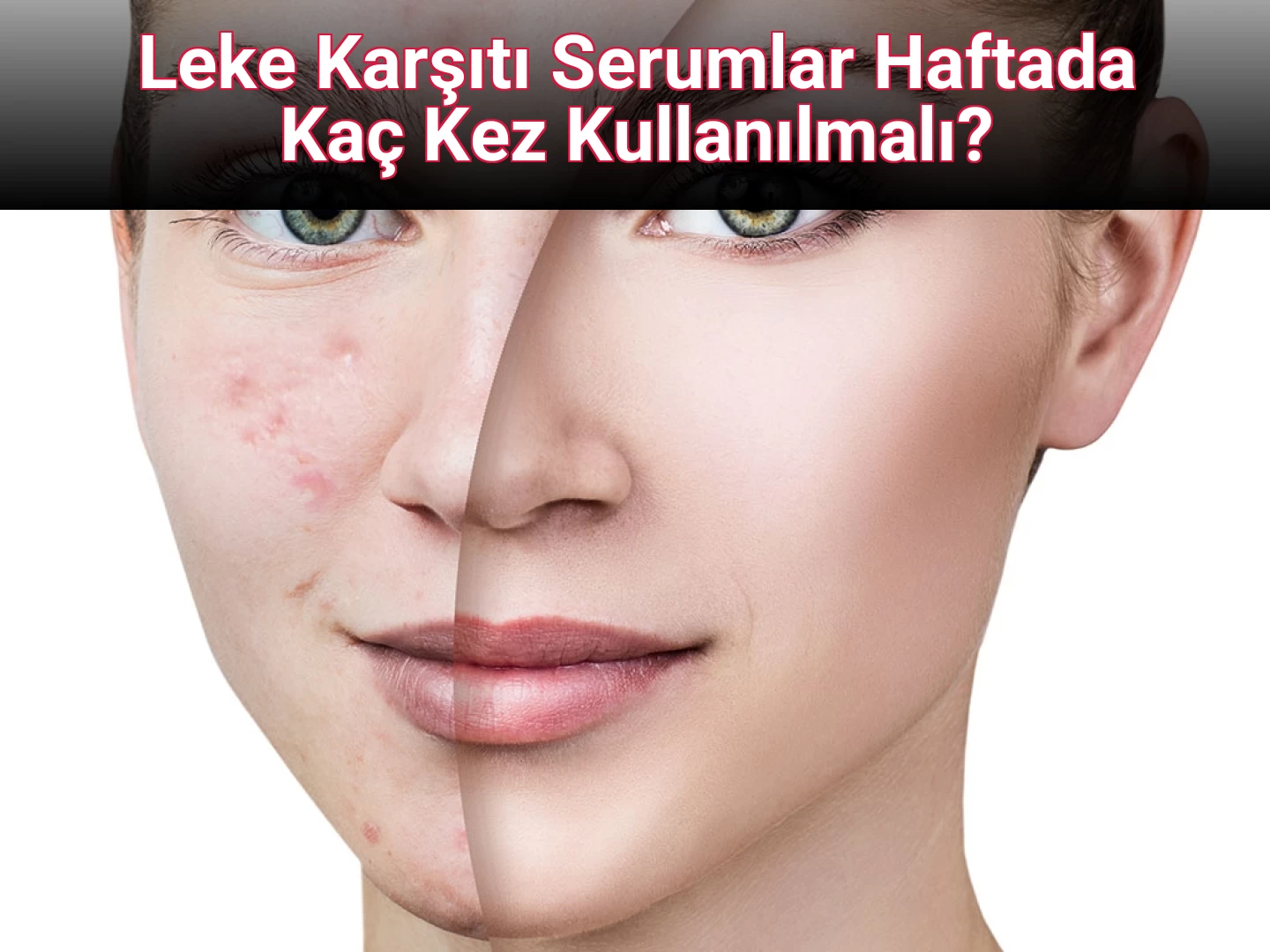 Leke Karşıtı Serumlar Haftada Kaç Kez Kullanılmalı?