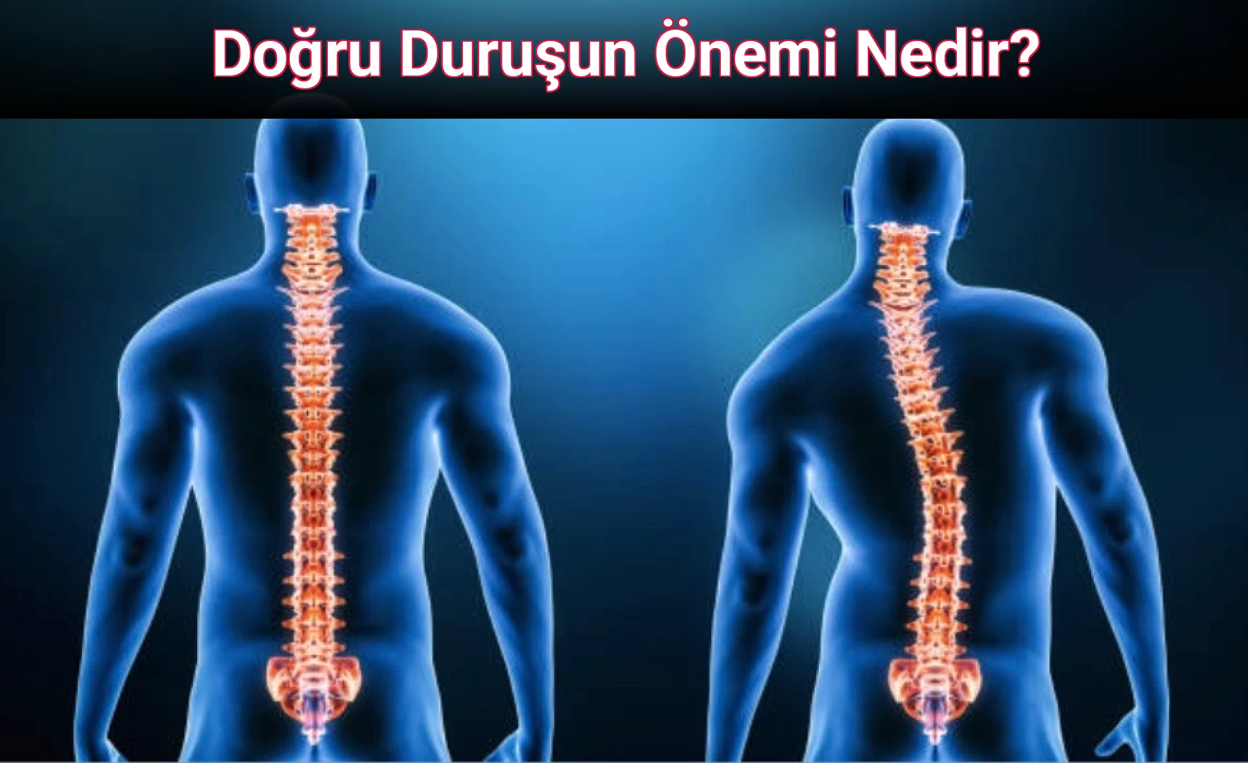 Doğru Duruşun Önemi Nedir?
